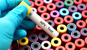 Why To Protect Your Health With HPV Testing in NYC