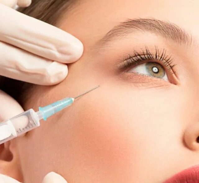 Dermal Filler Injections Before and After Realistic Expectations